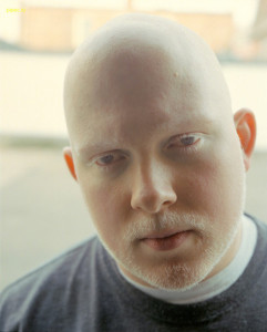 Частичный альбинизм