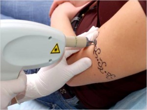 «Диагностическая татуировка» для диабетиков