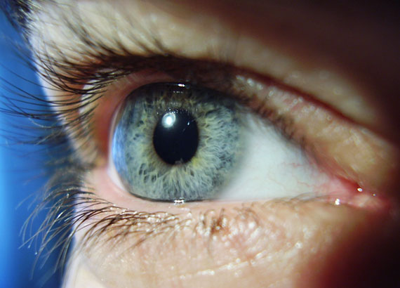 Диабетическая ретинопатия приводит к слепоте