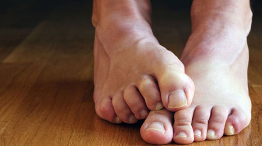 Онемение ног при диабете