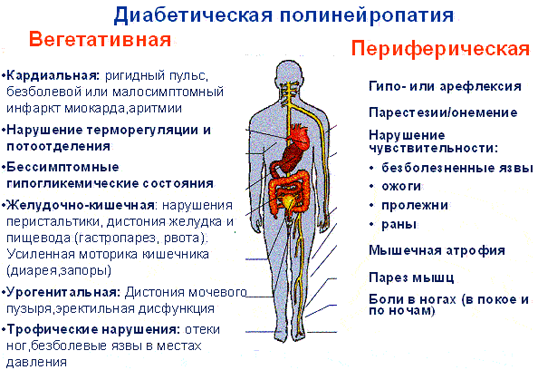 Как управлять диабетической нейропатией