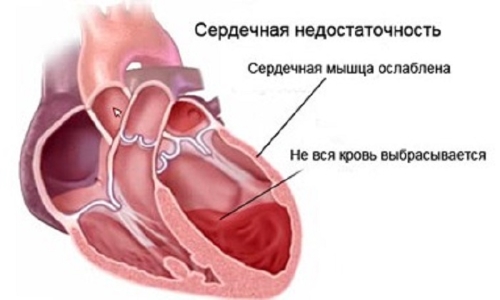 Берегите сердце смолоду