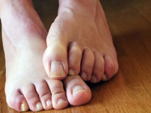 Жжение в ногах при диабете
