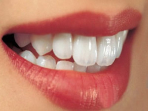 Циркониевые коронки: эффект «живых» зубов