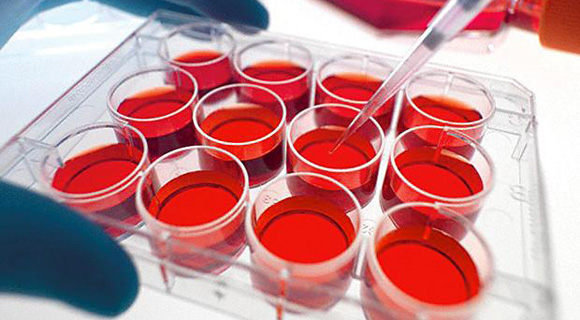 Могут ли стволовые клетки крови привести к излечению?