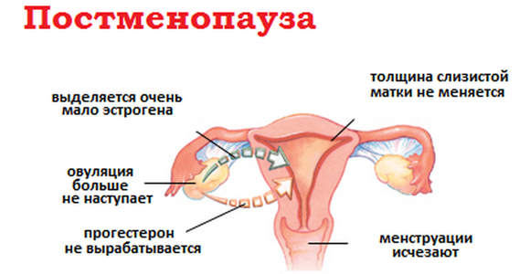 Постменопауза